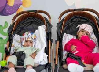 British Surgeon Successfully Separates Rare Conjoined Twins in Groundbreaking Operation news-20092024-064119