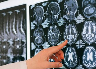 Bristol Hospital CT: What Makes It a Top Choice for Patients?